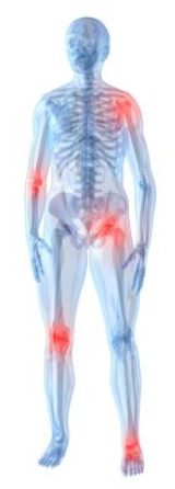 Pain areas.jpg