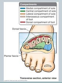 Compartment Syndrome of the Foot - Physiopedia