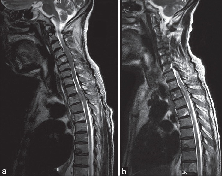 File:CT spinal cord.jpg