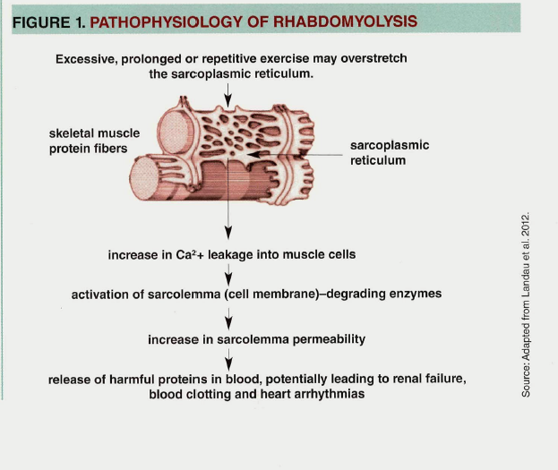 How likely do you develop rhabdomyolysis after following statins therapy?