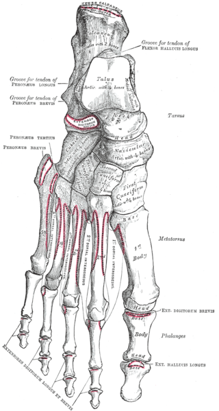 Chopart fracture-dislocation - Physiopedia