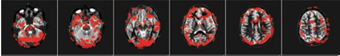 FMRI row 2.png