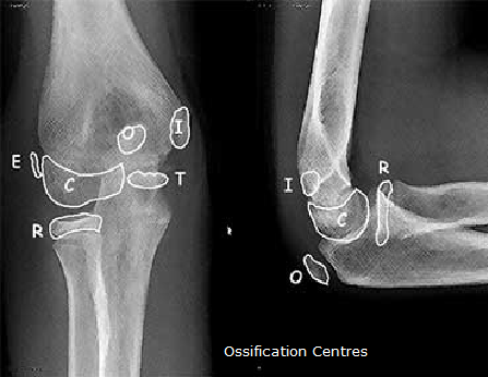 File:Ossification centres.png