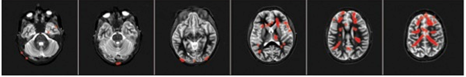 FMRI row 3.png