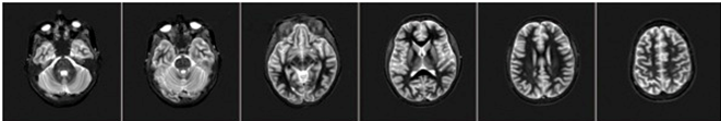 FMRI row 1.png