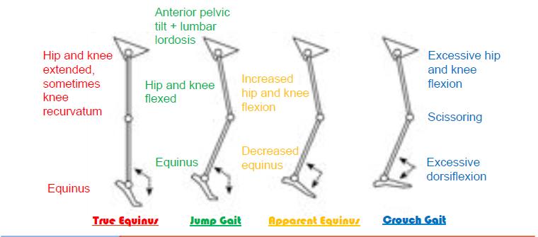 Classification of CP gait .jpg