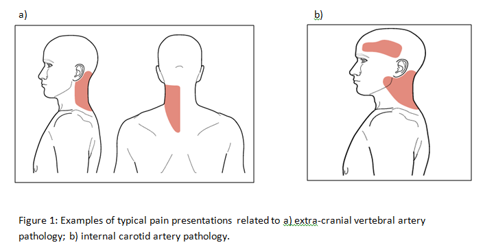 Pain diagram CAD.png