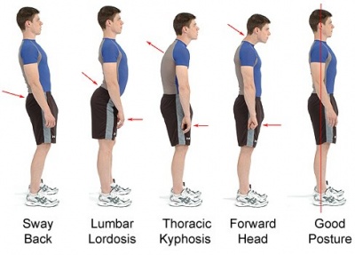 Examples of Different Postures