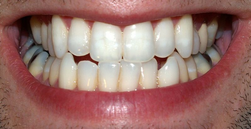 File:Teeth.jpg