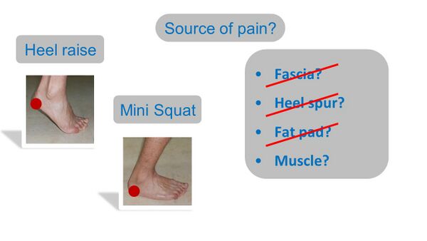 Sources of heel pain with clinical tests.jpg