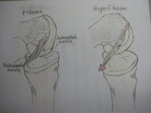 PCL Flexion and Hyperflexion