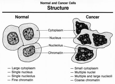 Normal and cancer cells structure.jpg
