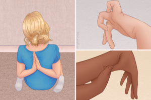 These 3 pictures depict some hypermobility traits: the ability to put hands in the "prayer" position behind the back, W sitting (sitting with knees bent and the legs splayed on either side), a "double-jointed" little finger, and the ability to touch the thumb to the wrist of the same hand.