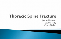 Thoracicspine fracture2 ppt.PNG