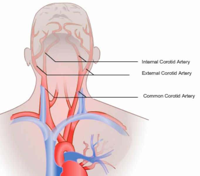 File:Common carotid 143812.png