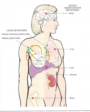Breast Cancer Metastases Diagram1 .jpg