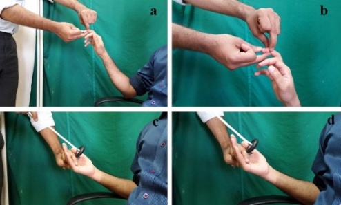The method of eliciting the reflexes. a & b = Hoffman's reflex . c & d = finger flexion