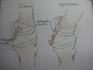 PCL Extension and Hyperextension
