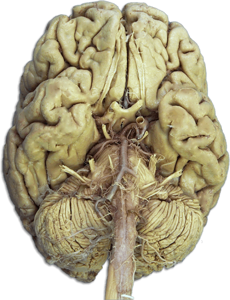 File:Cranial Nerves in Brain.png