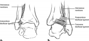 Syndesmosis ligaments.jpg