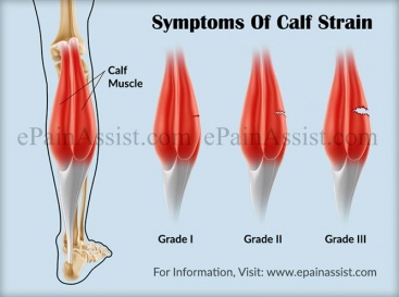 Symptoms-of-calf-strain.jpg