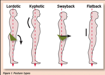 Posture Types.png