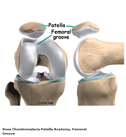 File:Femoral groove.png