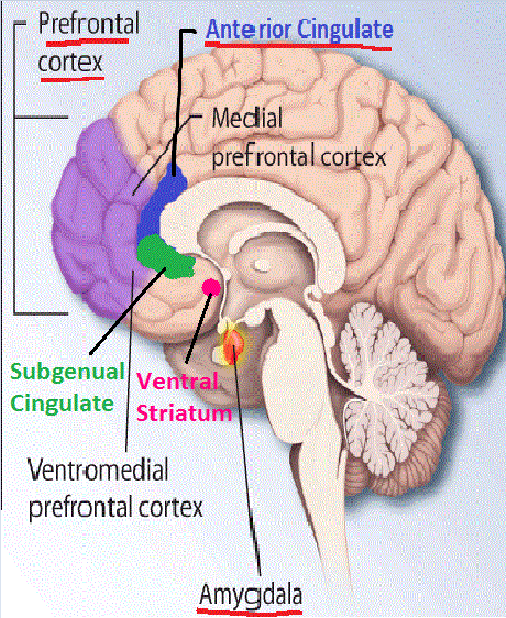 File:Borderline Personality Disorder (BPD) Abnormal Brain Structures.png