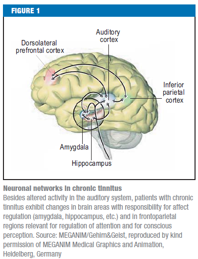 File:Brain tinnitus.png