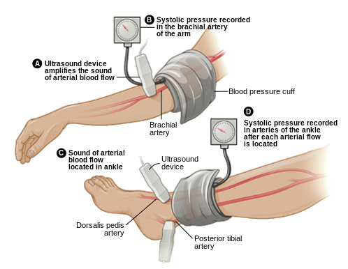 File:Ankle-brachail index.png
