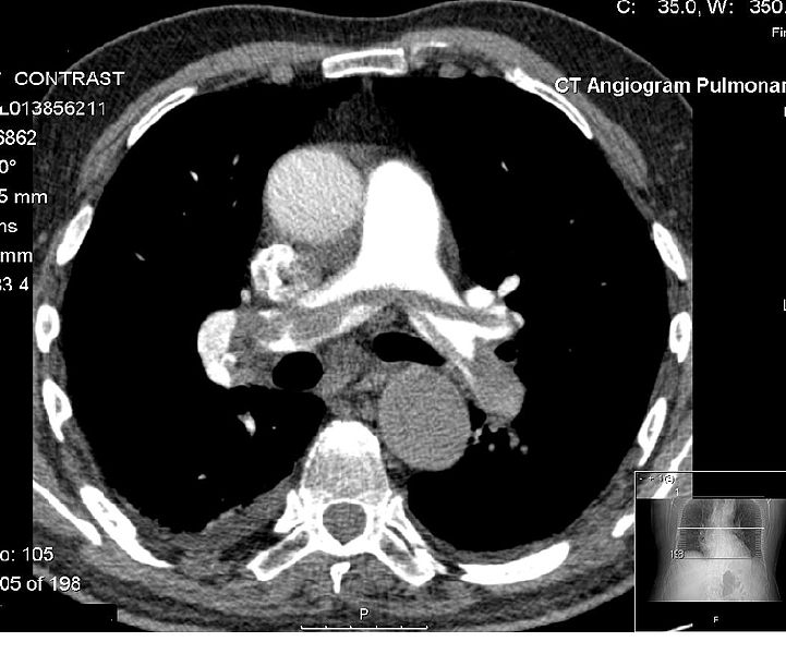 File:CT angiogram.JPG
