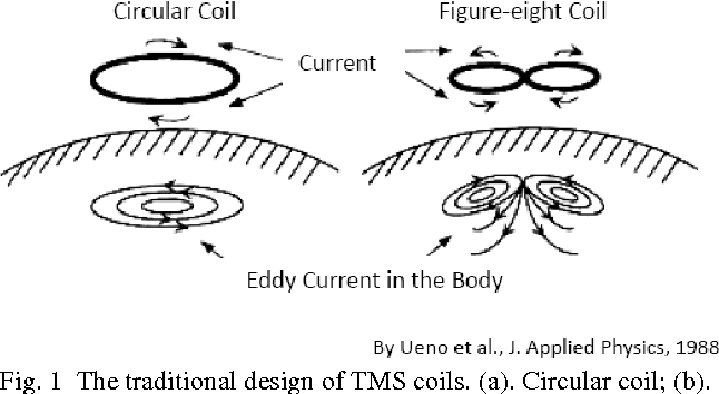 File:TSM coils.png