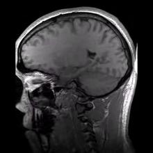 Structural MRI animation.ogv.jpg