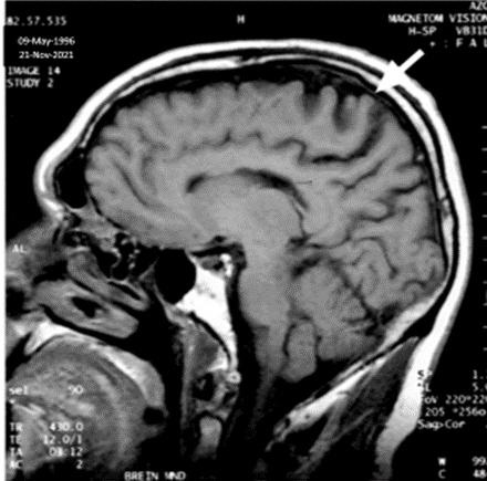 File:Mr. Parker's MRI Findings.png