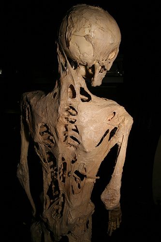 Henry Eastlack Skeleton
