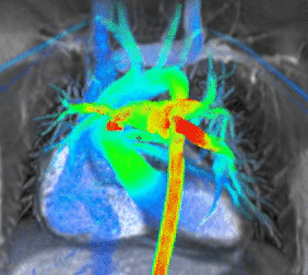 Cardiac MRI flow.gif