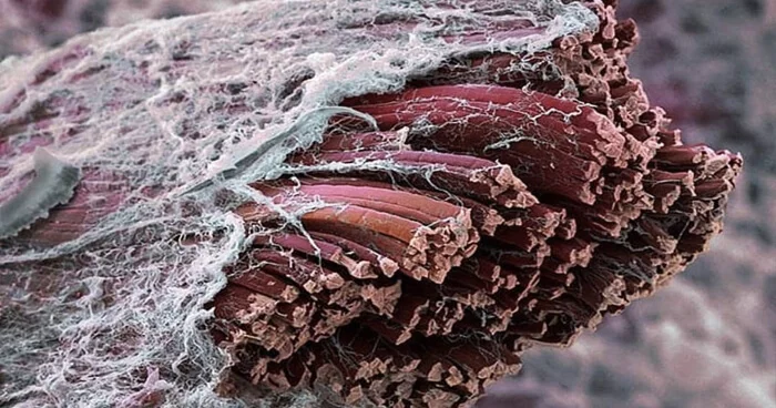 File:Fascia surrounding muscle fibre.png