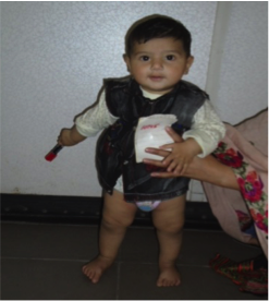 File:Case Study-Idiopathic Unilateral Clubfoot 5.png