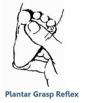 File:Plantar Grasp Reflex.jpg