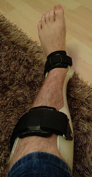 File:AFO Ankle Foot Orthosis Orthotic Brace.JPG