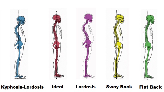 File:Spine-alignments.jpg