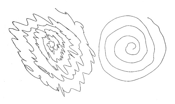 File:Spiral drawing - essential tremor.jpeg