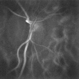 Laser Doppler holography of blood flow in the optic nerve head region of the human retina.gif
