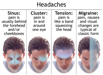 Characteristics of Headache Types