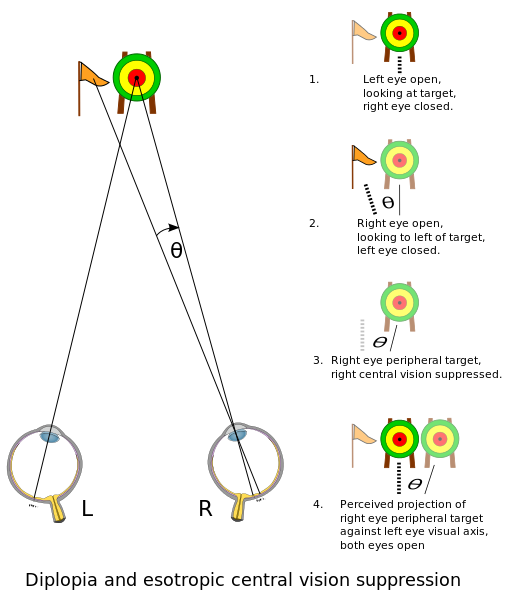 File:Figure of diplopia perception with English annotations.svg.png