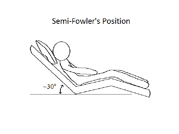 File:Semi-Fowler's-position.png