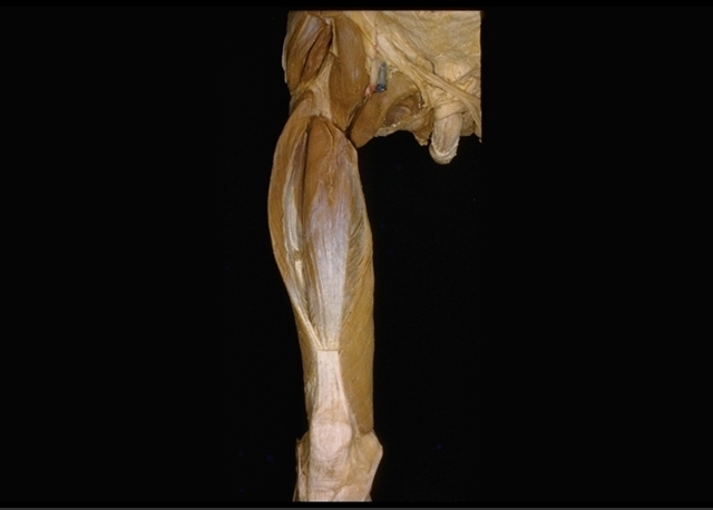 File:Quadriceps femoris anterior view LD.B.0188.007.L.jpg