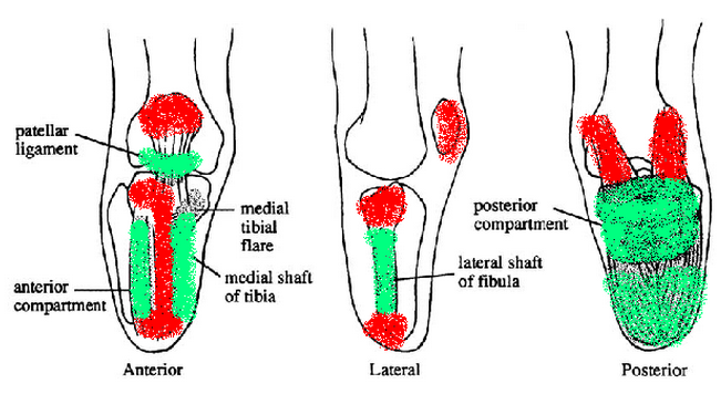 Prosthetics-pressure-areas.png