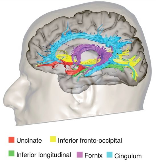 File:Limbic tracts.jpg