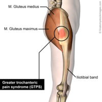 File:Hip greater trochanter glut max side view.png